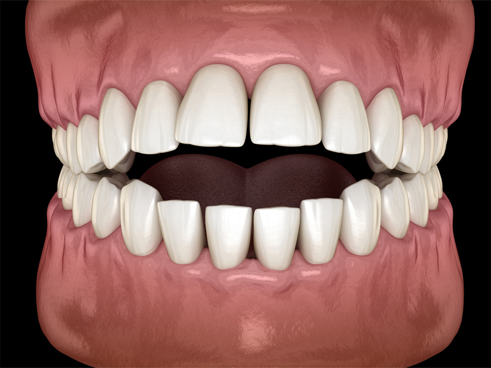 a detailed 3D rendering of a closed mouth, showcasing the upper and lower sets of teeth.